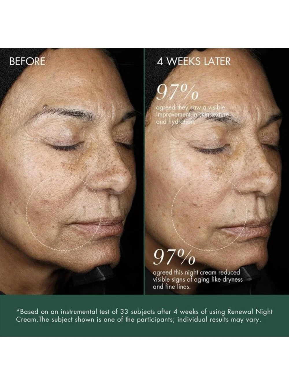 Renewal Discovery Set - Rescue Elixir Oil & Moisturizing Night Cream Trial Kit